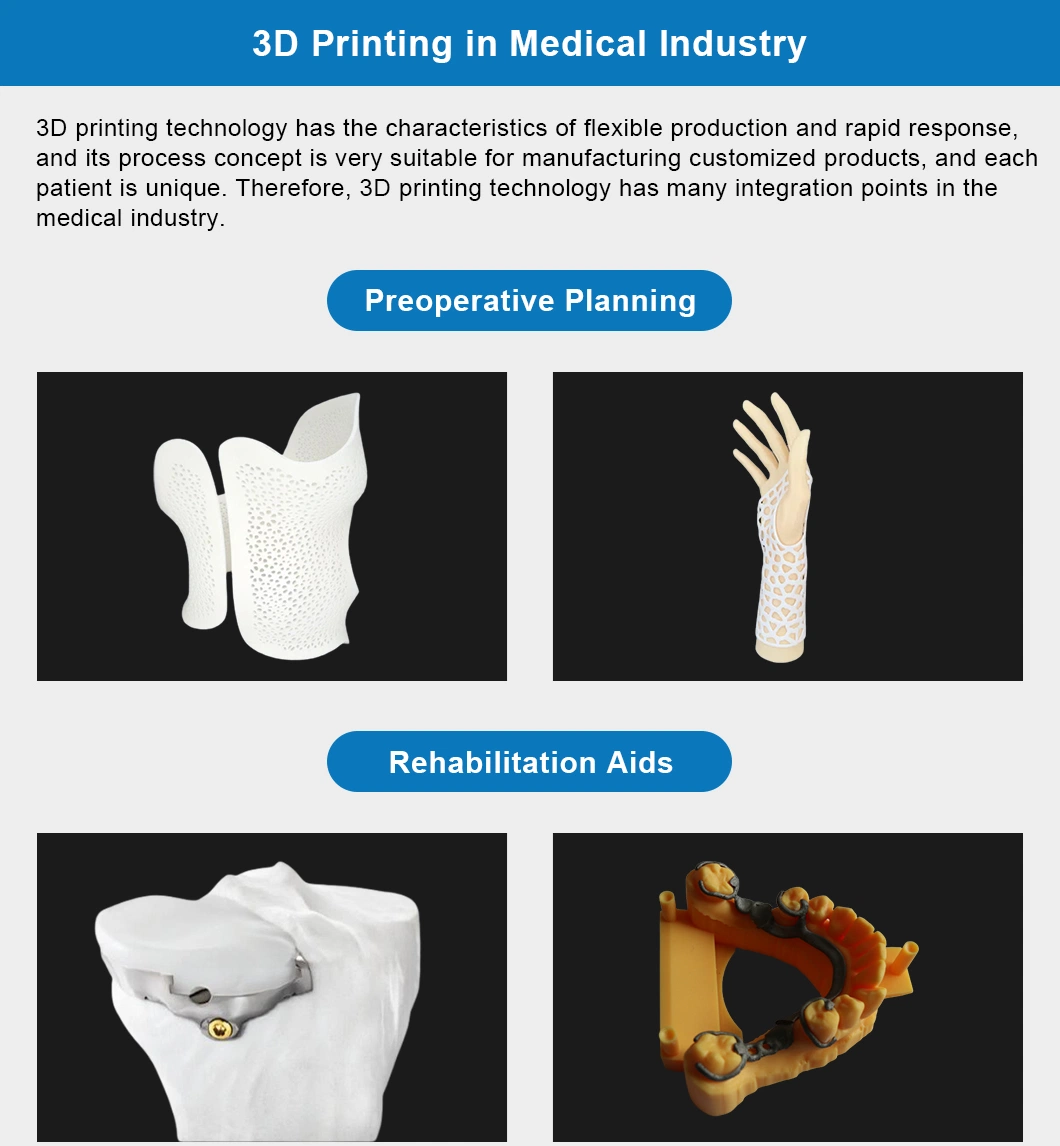 China SLA Yellow Resin Fdm/SLA/Slm/SLS/DLP Custom Made 3D Printinjection Molding