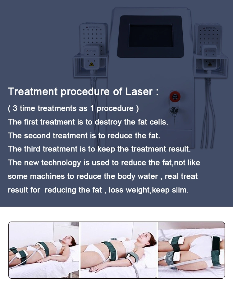 Stationary 408 Diodes Zerona Laser Treatment for Weight Loss Equipment Fat Burning Laser Cellulite Reduction Beauty Machine or Salon Use Br508