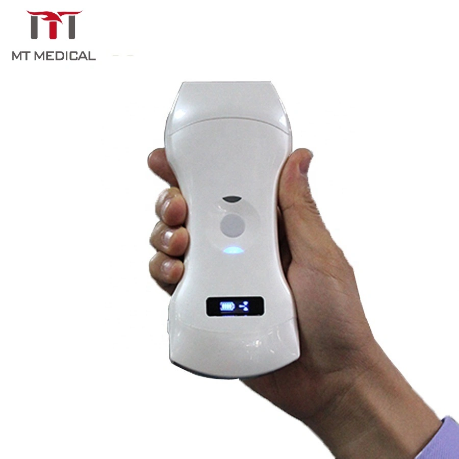 Wireless Mini Doppler Ultrasound Scanner Professional Medical Medical Ultrasound Detector