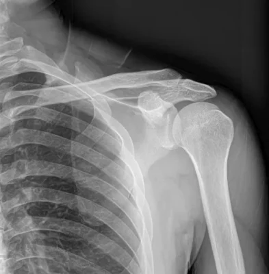 Mars 1717V Human Veterinary Iray Wireless 17*17&prime;&prime; Dr Flat Panel Детектор