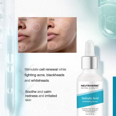 Hyperpigmentation Skin Care Hydrating Salicylic Acid Organic Face Serum with Boxes