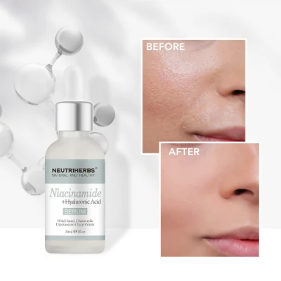 Private Label Whitening Skin Minimizing Large Open Clogged Pore Niacinamide Serum