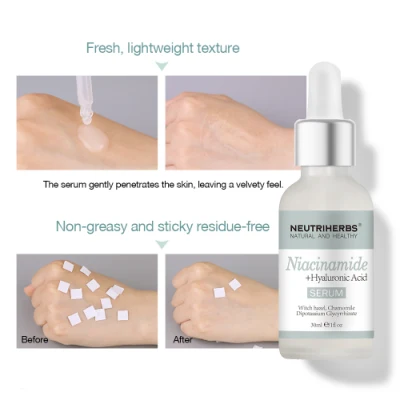 Private Label Whitening Skin Minimizing Large Open Clogged Pore Niacinamide Serum