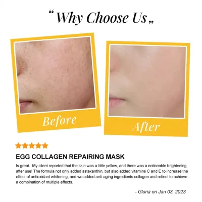 Di Tong OEM/ODM Luxury Sleep Collagen Hydrogel Melting Facial Mask