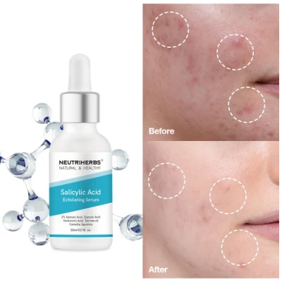Hyperpigmentation Skin Care Hydrating Salicylic Acid Organic Face Serum with Boxes