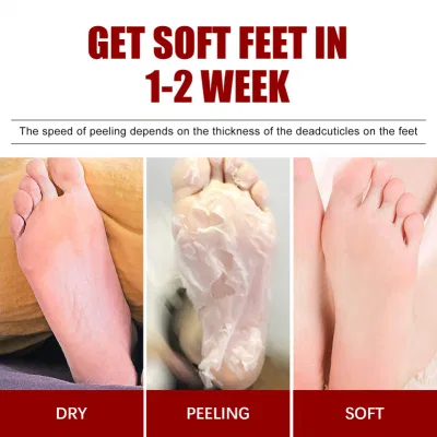 OEM Larger Size Exfoliating Callus Foot Peeling Pack Exfoliating Remover Care Feet Peel off Foot Masks