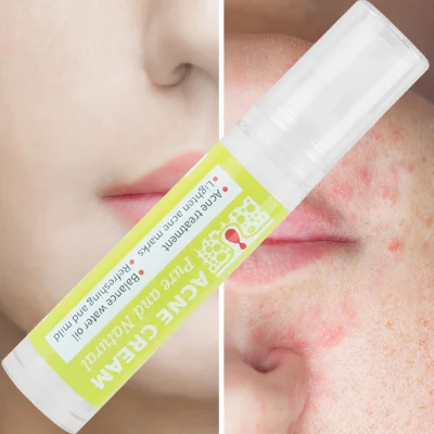 Natural Organic Oil Control Shrinks Pores Woman Skincare Deep Cleansing Acne Cream