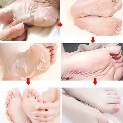 OEM Larger Size Exfoliating Callus Foot Peeling Pack Exfoliating Remover Care Feet Peel off Foot Masks