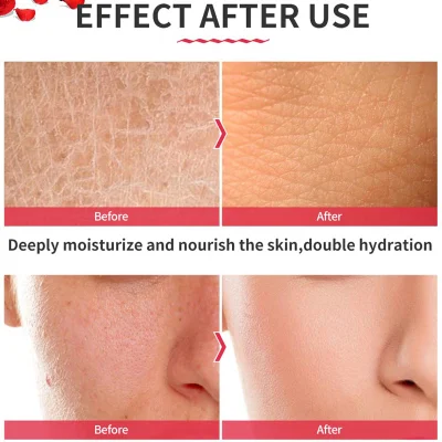 OEM Face Whitening Skin Care Clean Peel off Jelly Rubber Facial Mask Powder