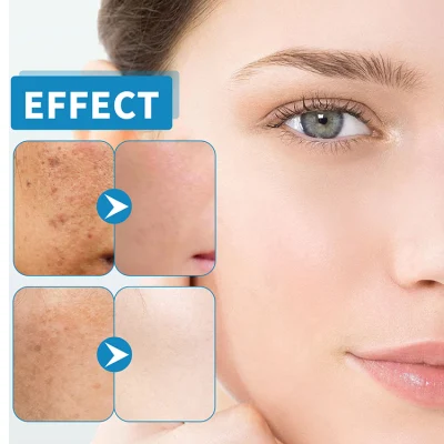 Organic Facial Anti Aging Olive Cucumber Mulberries Face Skin Care Lighten Spots Acne Marks Repairing Moisturize Skin Face Serum