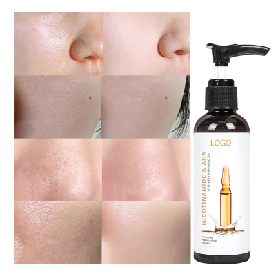 on Sale Nectar with Remove Freckle Cleanser Cream Whiten Cleanser Face Wash