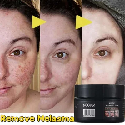 Dark Spots Corrector Face Bleaching Cream Whitening for Black Skin