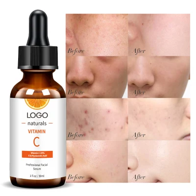 Best Selling Vitamin C with Hyaluronic Acid Anti Aging Face Serum Skin Care