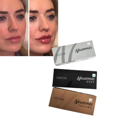 Good Effect 1ml Neuramis Hyaluronic Acid Lido for Facial
