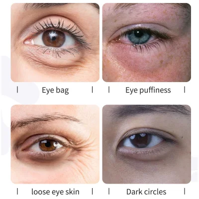 Eye Bag Remover Tube Eye Cream for Dark Circles