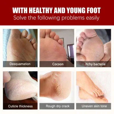 OEM Larger Size Exfoliating Callus Foot Peeling Pack Exfoliating Remover Care Feet Peel off Foot Masks