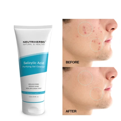 High Quality Amino Acid Salicylic Acne Face Wash Facial Cleanser