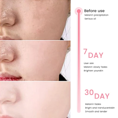 Ekber 4 in 1 Serum Custom Packing Wholesale Skin Whitening Anti Wrinkle Reducer Formula Vc Vitamin C Serum for Face