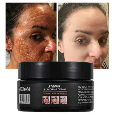 Dark Spots Corrector Face Bleaching Cream Whitening for Black Skin