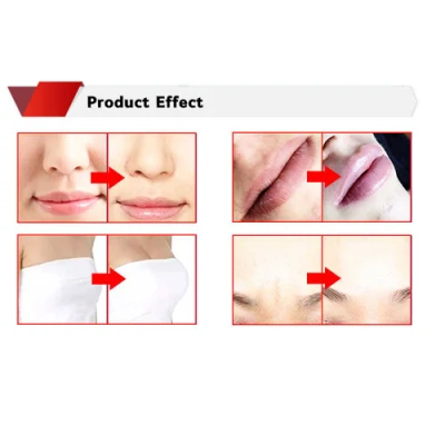 Korean High Safety Dermal Filler 10ml for Butt