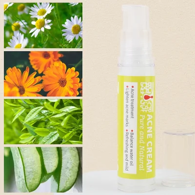Natural Organic Oil Control Shrinks Pores Woman Skincare Deep Cleansing Acne Cream