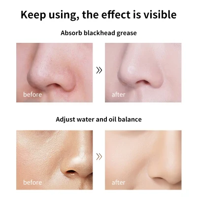 Wholease Mascarilla Hidratante Beauty Skin Care Purifying Removing Blackhead Facial Clay Mask Deep Cleansing Oil Control Black Charcoal Face Mud Mask
