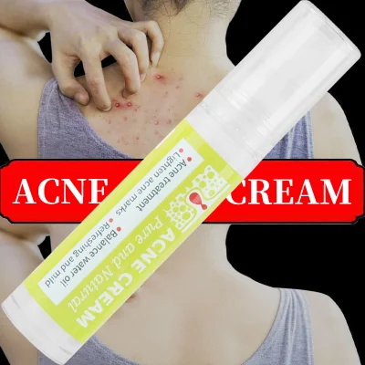 Natural Organic Oil Control Shrinks Pores Woman Skincare Deep Cleansing Acne Cream