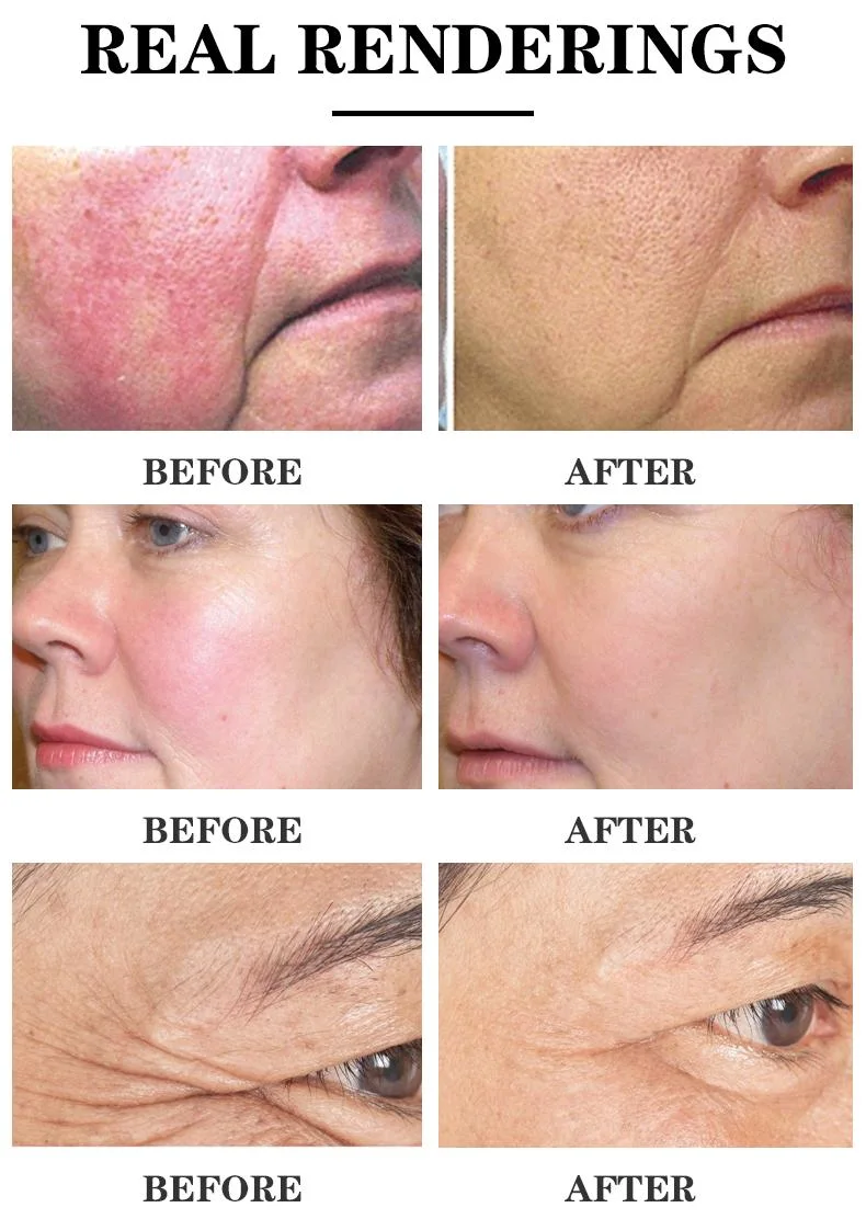 Deep Hydrating Soothing Dry Skin Repair Damaged Face Rose Facial Nourishing Toner