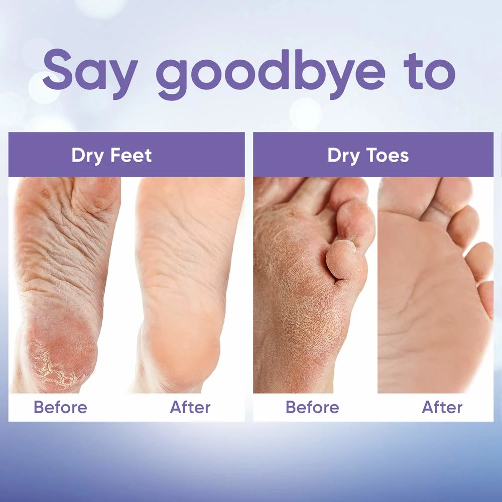 OEM Larger Size Exfoliating Callus Foot Peeling Pack Exfoliating Remover Care Feet Peel off Foot Masks