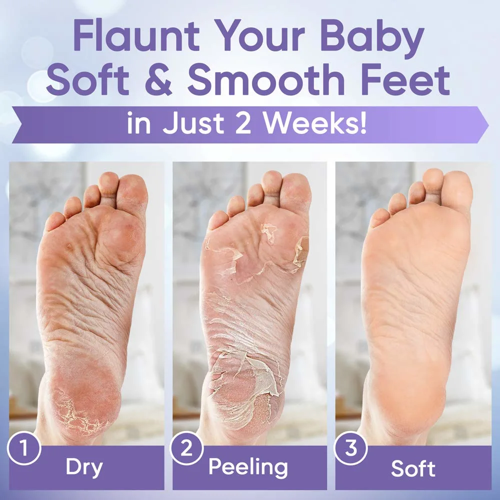 OEM Larger Size Exfoliating Callus Foot Peeling Pack Exfoliating Remover Care Feet Peel off Foot Masks