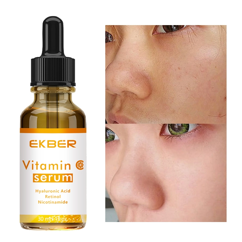 Wholesale Ekber Glowing Face Care Serum Repairing Serum Nicotinamide Whitening Skin Care Vitamin C Serum