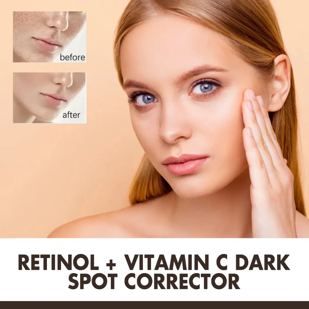 Online Wholesale Ready to Ship Private Label Dark Spot Corrector Cream with Collagen Retinal for Face and Body Melasma Sun Spot Age Spot Remover Cream