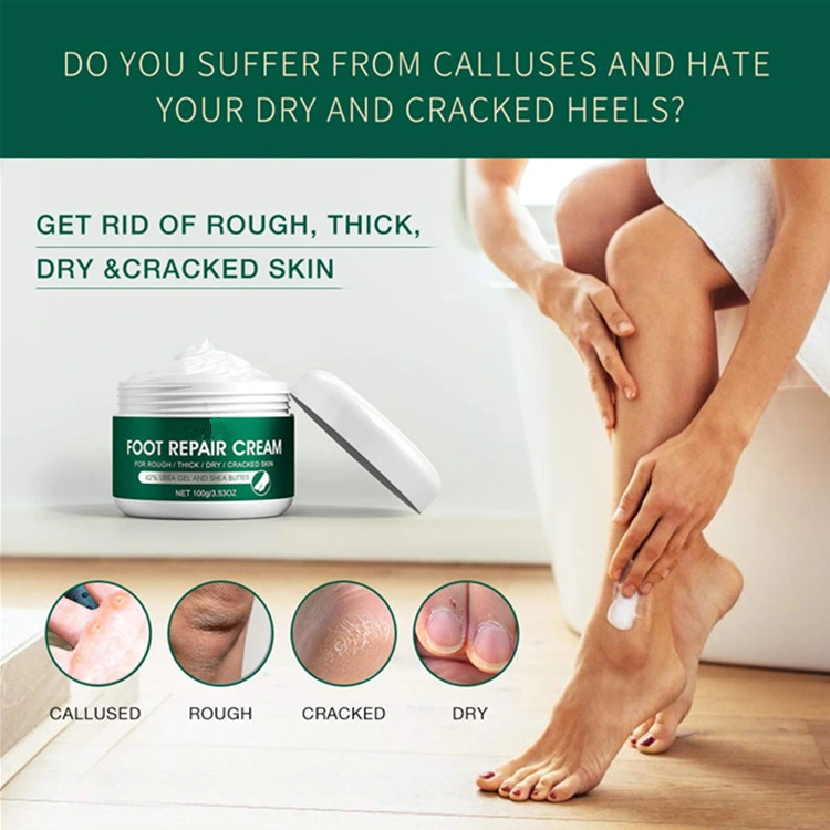 OEM Best Callus Remover Softening Rough Skin Foot Repair Cream