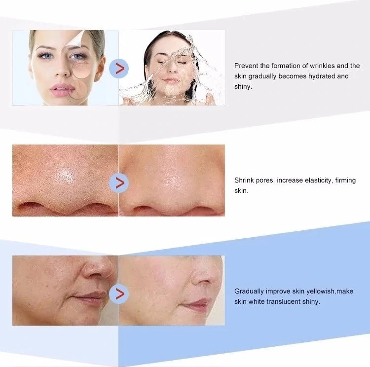5ml Skin Repairing Mesotherapy Serum Injection for Anty Aging