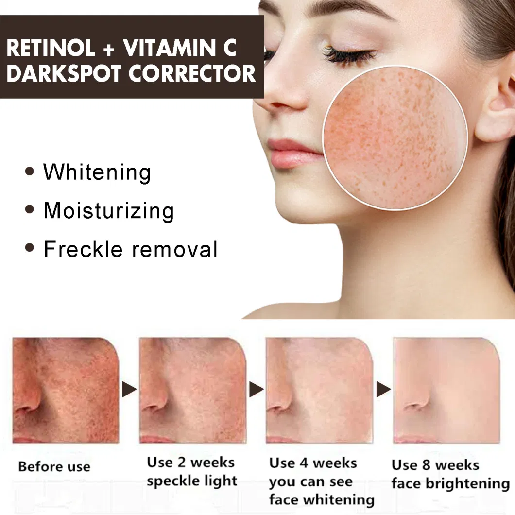 Online Wholesale Ready to Ship Private Label Dark Spot Corrector Cream with Collagen Retinal for Face and Body Melasma Sun Spot Age Spot Remover Cream