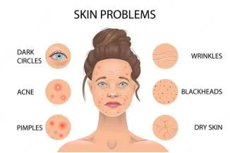 Top Suppliers Anti Aging Repair Skin Sun Damage Otesaly Skin Rejuvenating Serum Pdrn Mesotherapy Serum