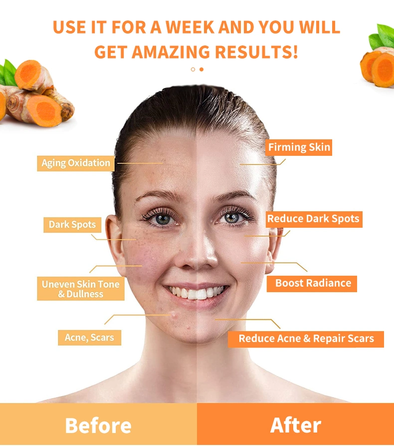 Organic Vitaminc Turmeric Lightens Dark Spots Moisturizing Anti-Aging Facial Mud Mask