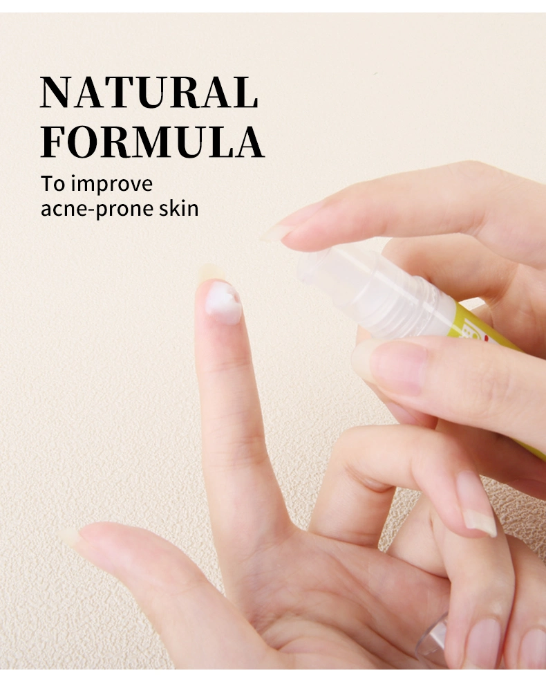 Natural Organic Oil Control Shrinks Pores Woman Skincare Deep Cleansing Acne Cream