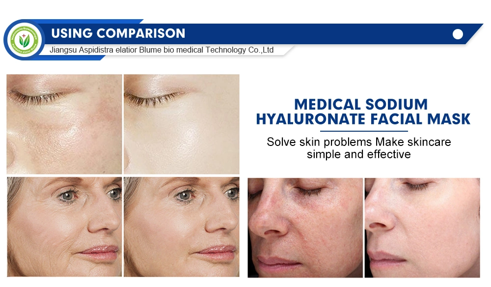 Medical Sodium Hyaluronate Skin Repair Dressing Hyaluronic Acid Sheep Placenta Hydrogel Facial Mask Sheet