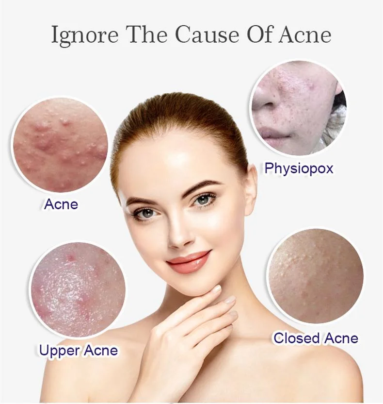 Aixin OEM Organic Face Serum + Vitamin C, Acne Treatment, Clear Skin Serum, Hydrate Dull &amp; Dry Skin, Anti-Aging Vitamin C Facial Serum