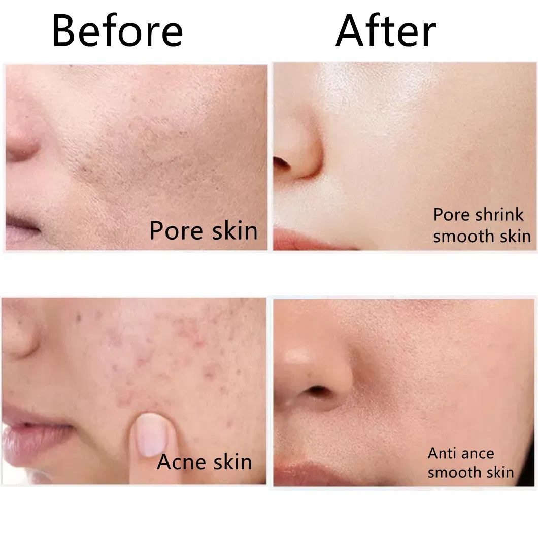 OEM High Quality Facial Cleanser Cream