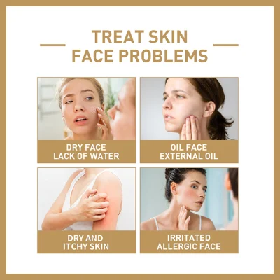  Etiqueta privada al por mayor Niacinamida arroz agua Moisturizing Toner blanqueando Cuidado de la piel tóner facial de arroz