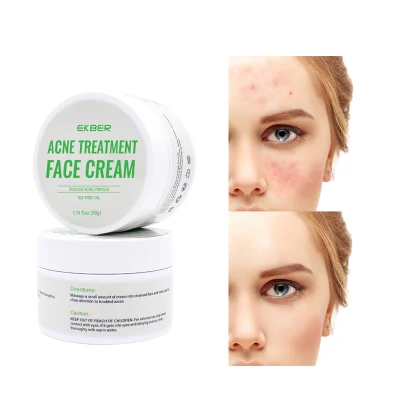 Extracto de planta de ácido salicílico suavizado Anti-Acne lujo crema limpiadora facial extracto vegetal Anti-Acne cremas faciales