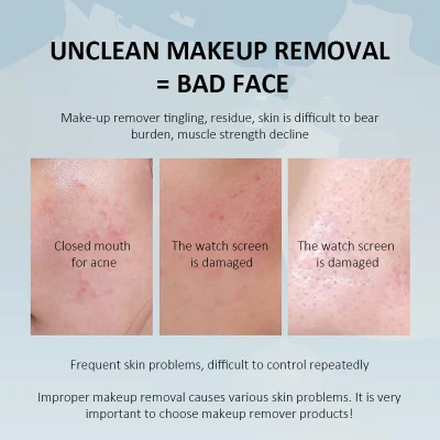 Cuidado de Piel de etiqueta privada Non-Irritating removedor de maquillaje líquido de limpieza profunda reborde de aceite ocular y facial hidratante suave aceite de limpieza