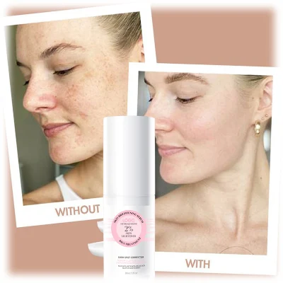  Aclaramiento de piel personalizado 2% Hydroquinone Remover Spots Corrector Dark Spot Suero