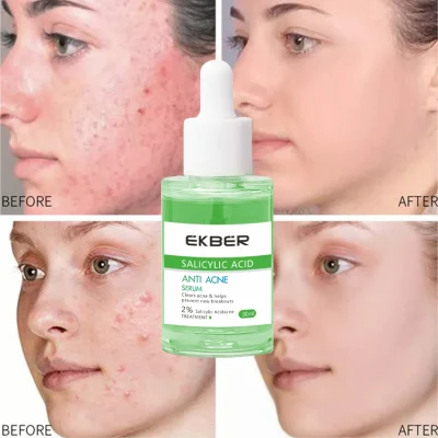  Etiqueta privada Organic Facial Cuidados de la piel manchas de acné Despede la piel Cicatriz calmante Adfado Anti suero de acné