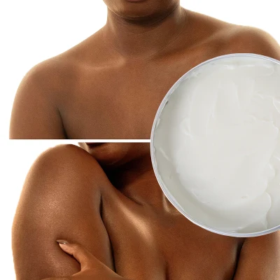 Venta caliente Hidrating Moisturizing Exfoliating mejorando la piel de pollo cuerpo de coco Crema de aceite