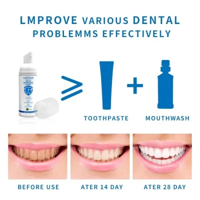 La pasta de dientes Dientes Blancos Limpieza Mousse de pegar el logotipo de etiqueta privada Kit de limpieza de espuma de Blanqueamiento Dental