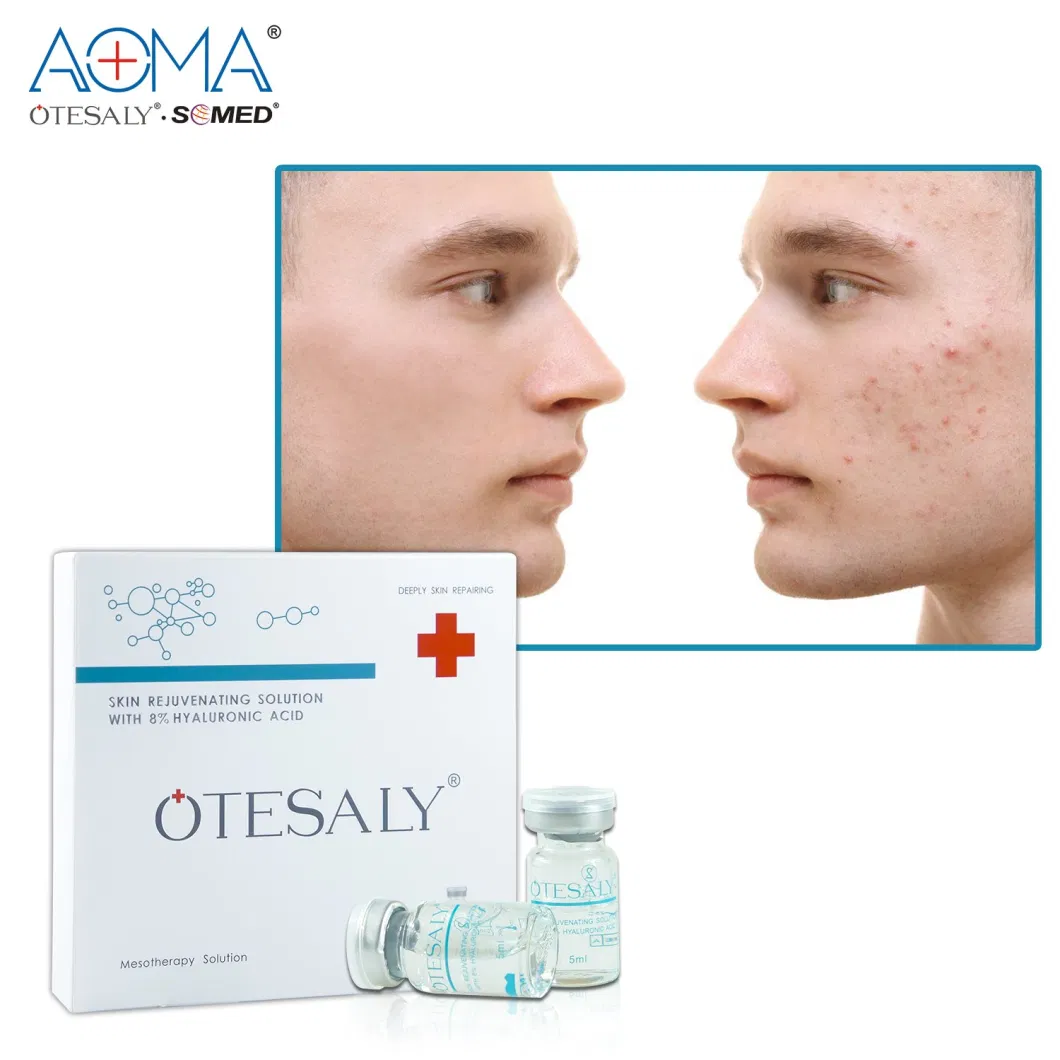 Customize Otesaly Deep Hydration Skin Rejuvenation 8% Hyaluronic Acid Face Lifting Anti Wrinkle Beauty Mesotherapy Solution Vitaminc Serum Whitening Serum