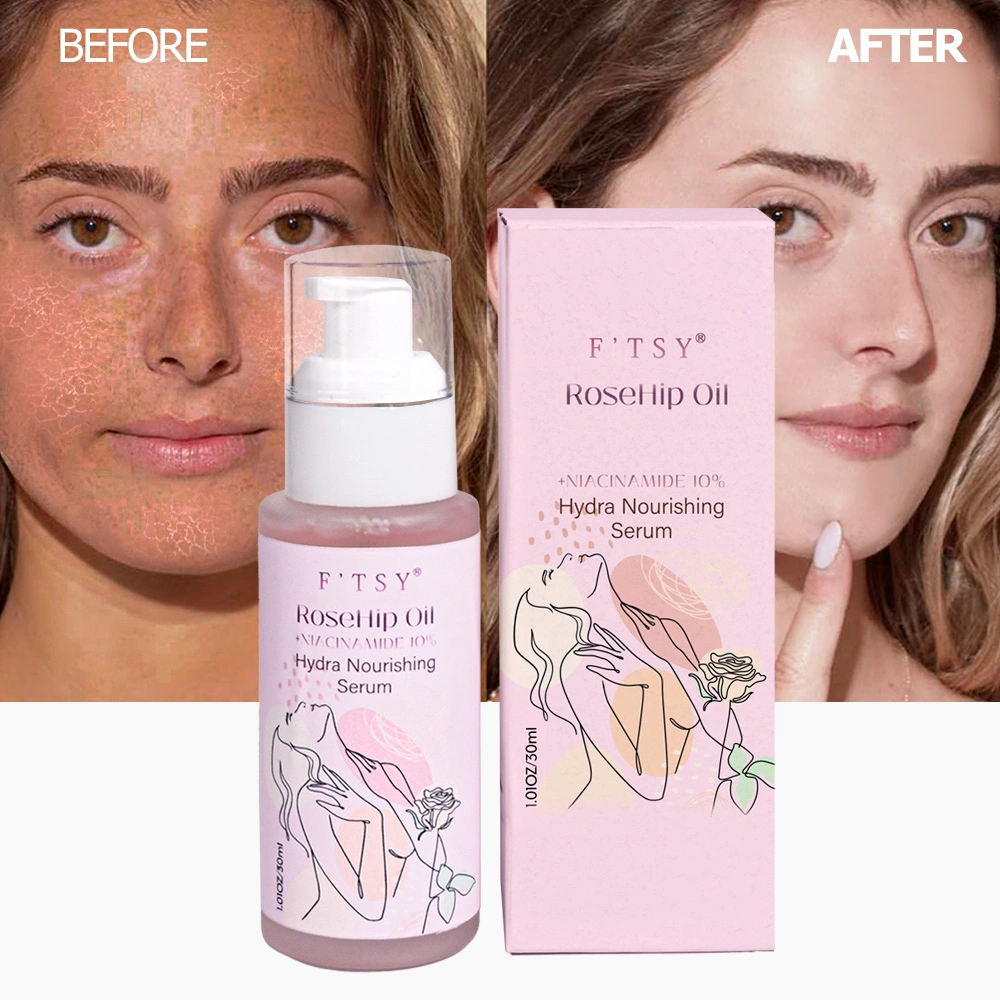 Custom Logo Vegan Moisturizing Brightening Natural Extract Skin-Friendly Rose Hydrating Face Oil Facial Serum
